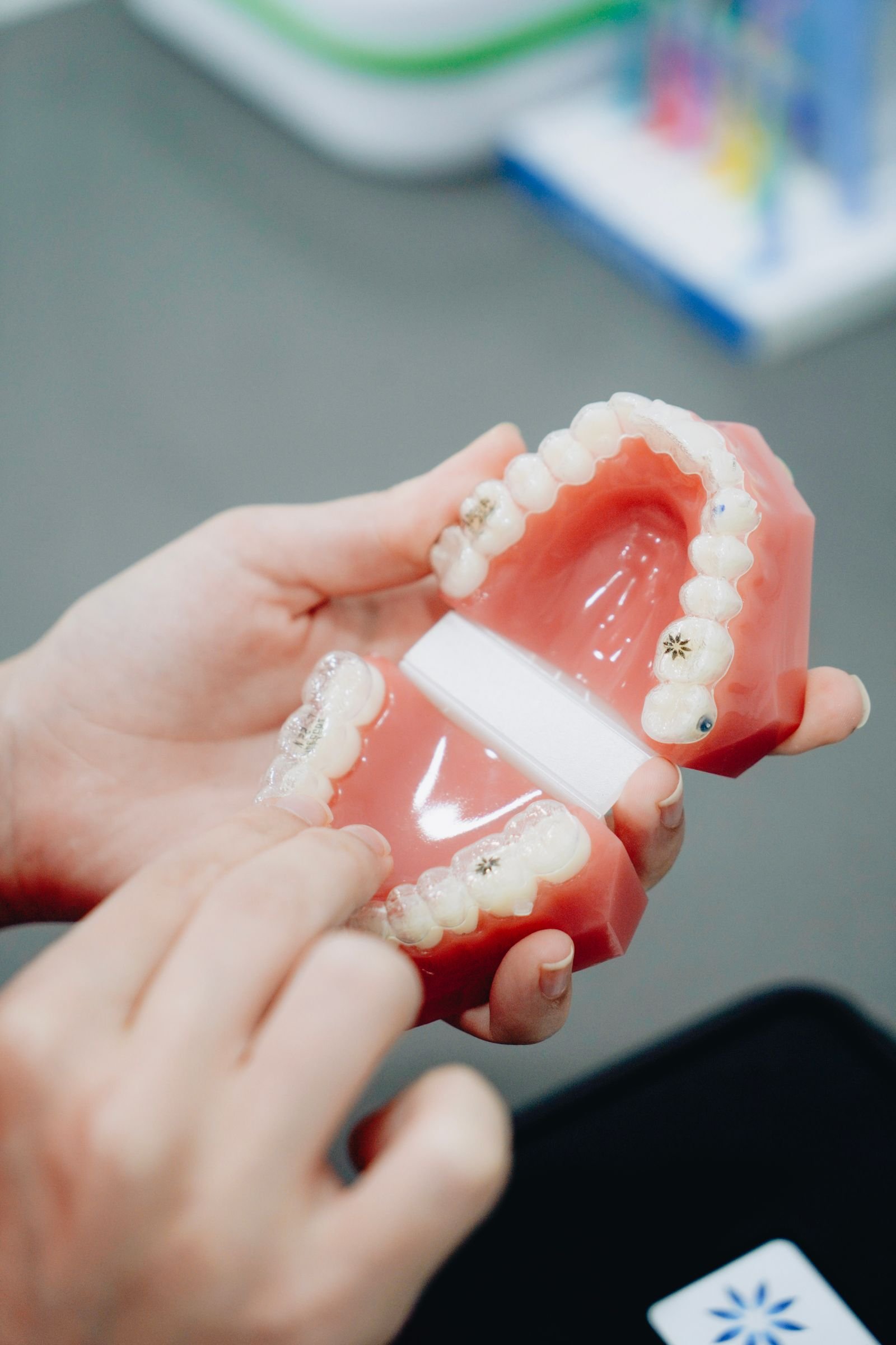 Metal braketli diş modeliyle ortodontik tedavi gösterimi